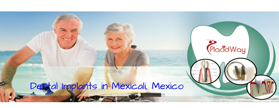 Dental Implants in Mexicali, Mexico